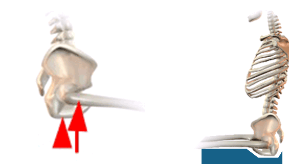 Anatomical illustration of a seat cushion pelvic loading area