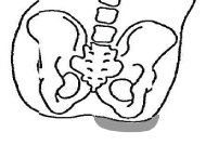 Flexible Pelvic Obliquity